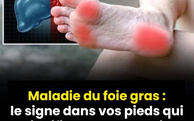 Maladie du foie gras : le signe dans vos pieds qui signifie que la maladie est installé