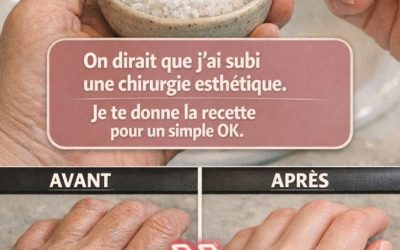 On dirait que j’ai eu recours à la chirurgie esthétique » : Le remède maison que beaucoup utilisent pour atténuer l’apparence des rides et des imperfections sur les mains et les bras