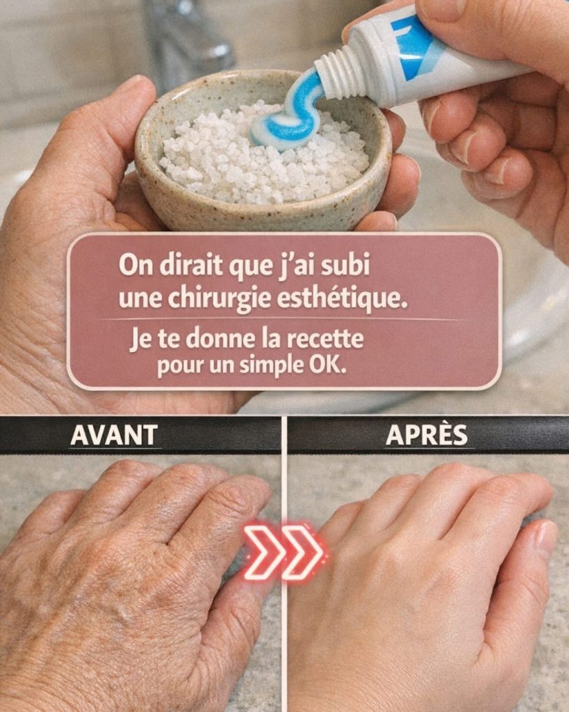 On dirait que j’ai eu recours à la chirurgie esthétique » : Le remède maison que beaucoup utilisent pour atténuer l’apparence des rides et des imperfections sur les mains et les bras