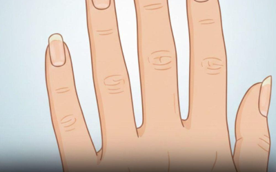Si vos ongles ressemblent à ça, il est temps de consulter un dentiste.