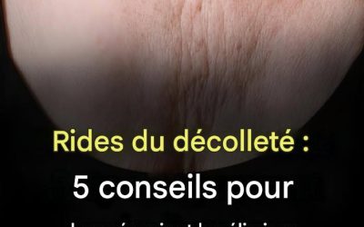 Rides du décolleté : 5 conseils pour les prévenir et les atténuer