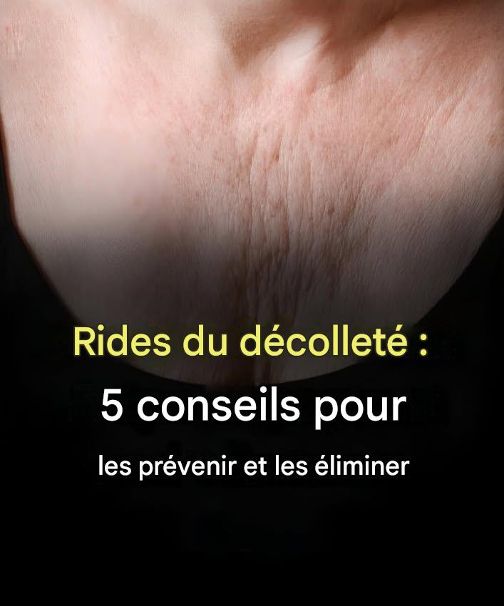 Rides du décolleté : 5 conseils pour les prévenir et les atténuer