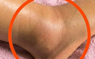 Jambes gonflées chez les seniors : causes, signes d’alerte et solutions