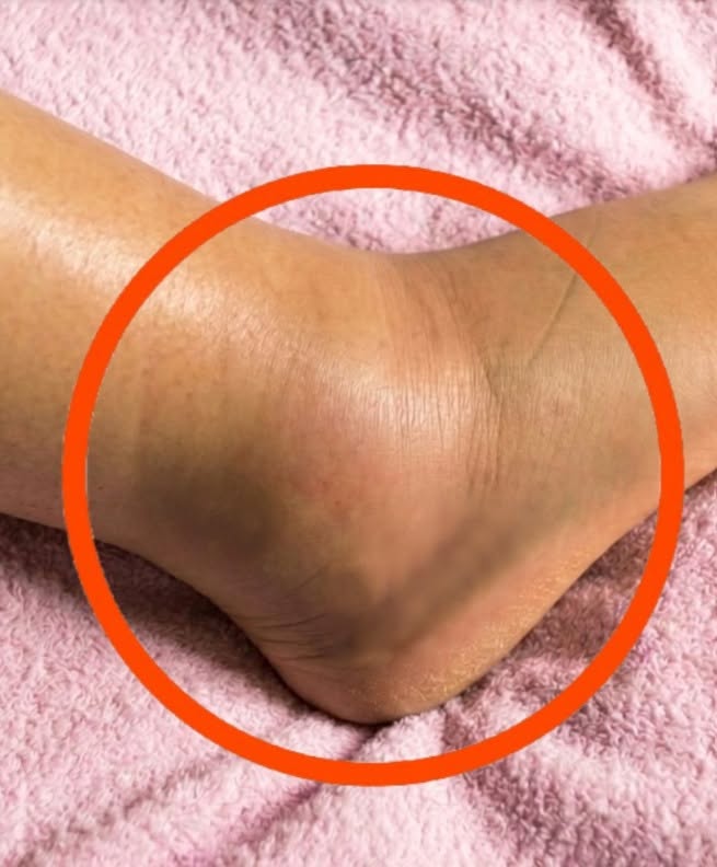 Jambes gonflées chez les seniors : causes, signes d’alerte et solutions