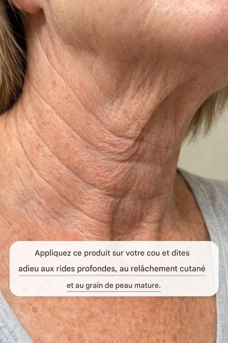 Appliquez ce produit sur votre cou et dites adieu aux rides profondes, au relâchement cutané et au grain de peau mature.