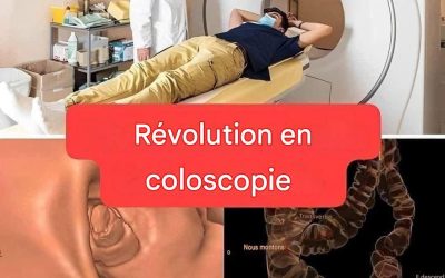 Nouvelle méthode : la coloscopie ne sera plus un examen invasif (1/2)