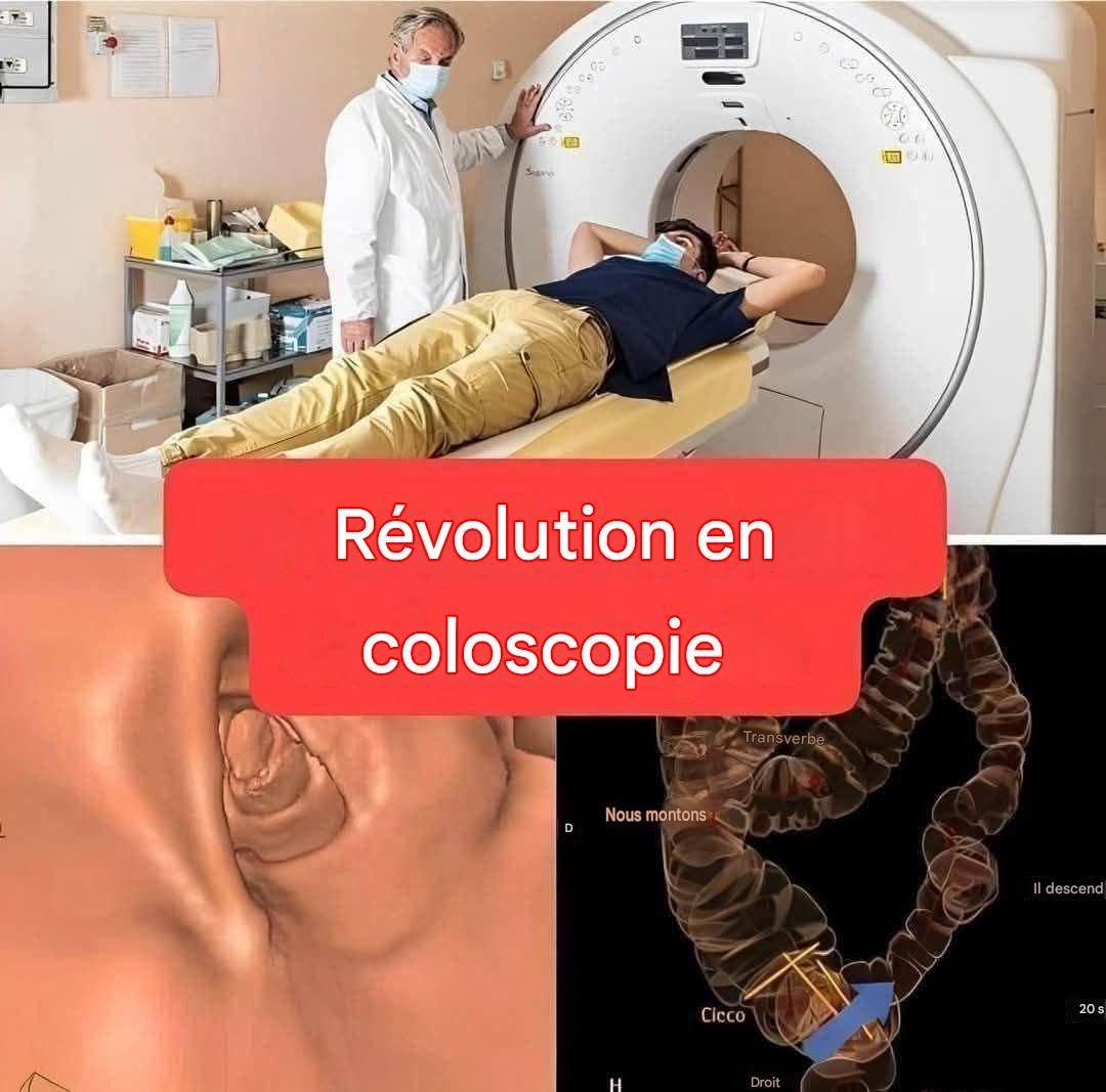 Nouvelle méthode : la coloscopie ne sera plus un examen invasif (1/2)