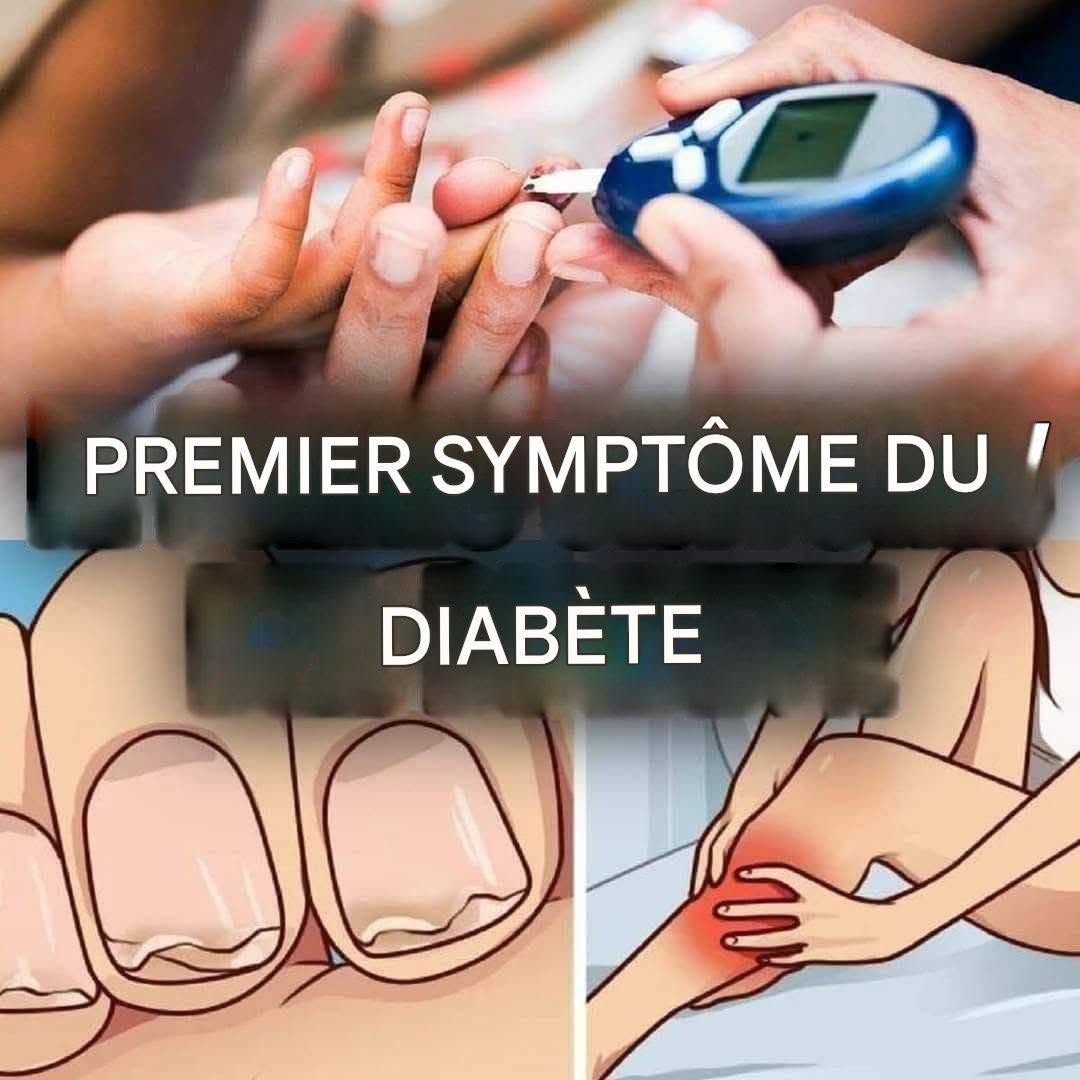 Voici les symptômes les plus surprenants du diabète (1/3)