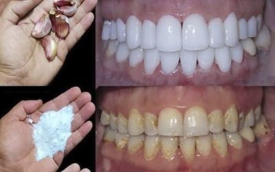 Comment blanchir les dents en 2 minutes?