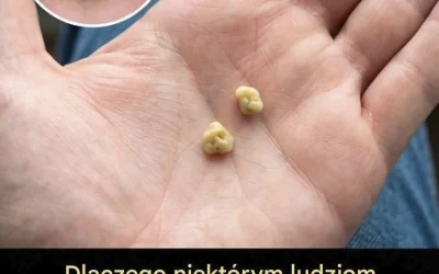 Calculs biliaires : que sont-ils et comment s’en débarrasser ?