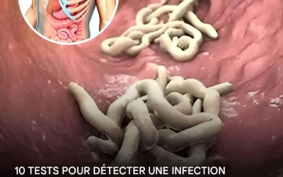 10 signes que votre corps est infesté de parasites ?