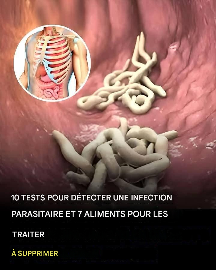 10 signes que votre corps est infesté de parasites ?