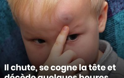 Il chute, se cogne la tête et décède quelques heures plus tard : les 11 signes d’alerte à surveiller chez un enfant, selon un médecin