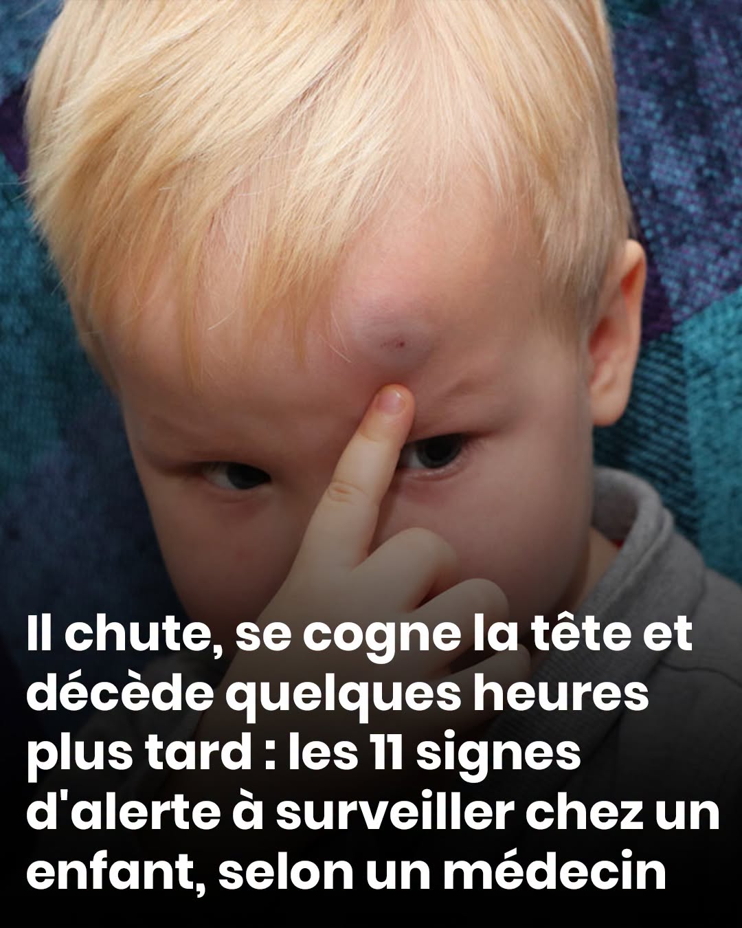 Il chute, se cogne la tête et décède quelques heures plus tard : les 11 signes d’alerte à surveiller chez un enfant, selon un médecin