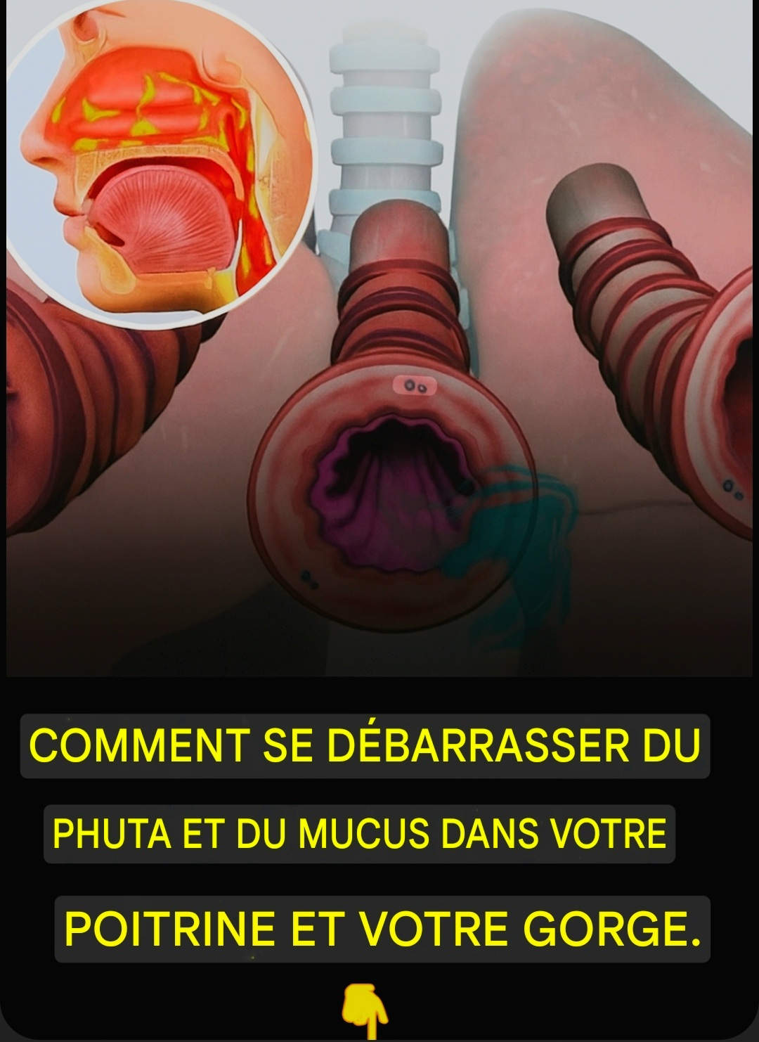 Comment se débarrasser des mucosités et du mucus dans la poitrine et la gorge.