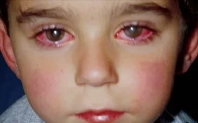 Les conséquences dramatiques d’un jouet commun sur la vue d’un adolescent