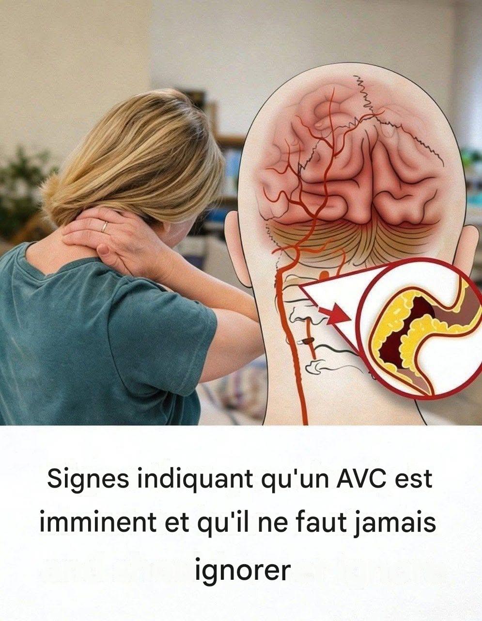 10 signes avant-coureurs d’un AVC que chacun devrait connaître pour agir rapidement