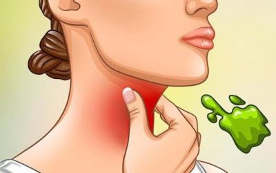 Les vraies causes des glaires et du mucus constant dans la gorge et comment s’en débarrasser
