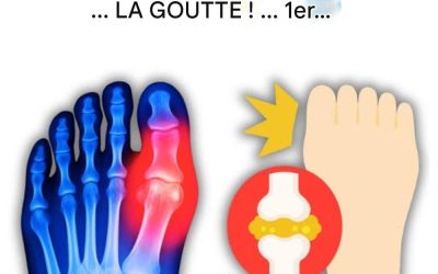 « Mon gros orteil était en feu… Jusqu’à ce que je découvre ces 5 boissons qui éliminent l’acide urique naturellement ! »