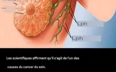 90 % des cas de cancer du sein pourraient être évités si les femmes suivaient ces 9 règles