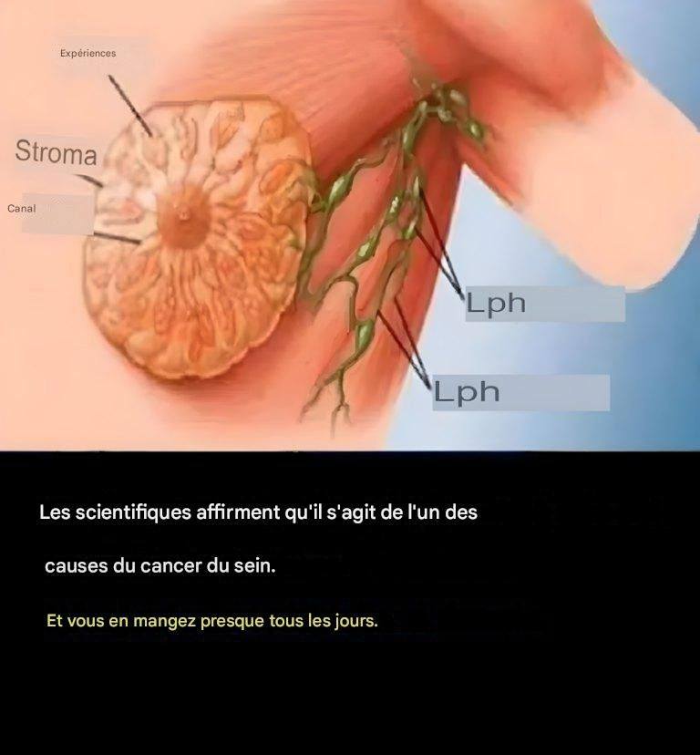 90 % des cas de cancer du sein pourraient être évités si les femmes suivaient ces 9 règles