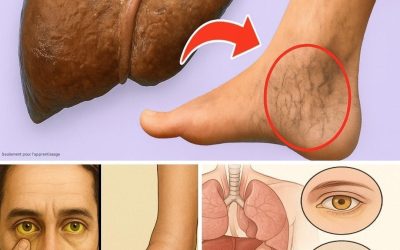 15 signes silencieux que votre foie est en difficulté – Agissez avant qu’il ne soit trop tard.??