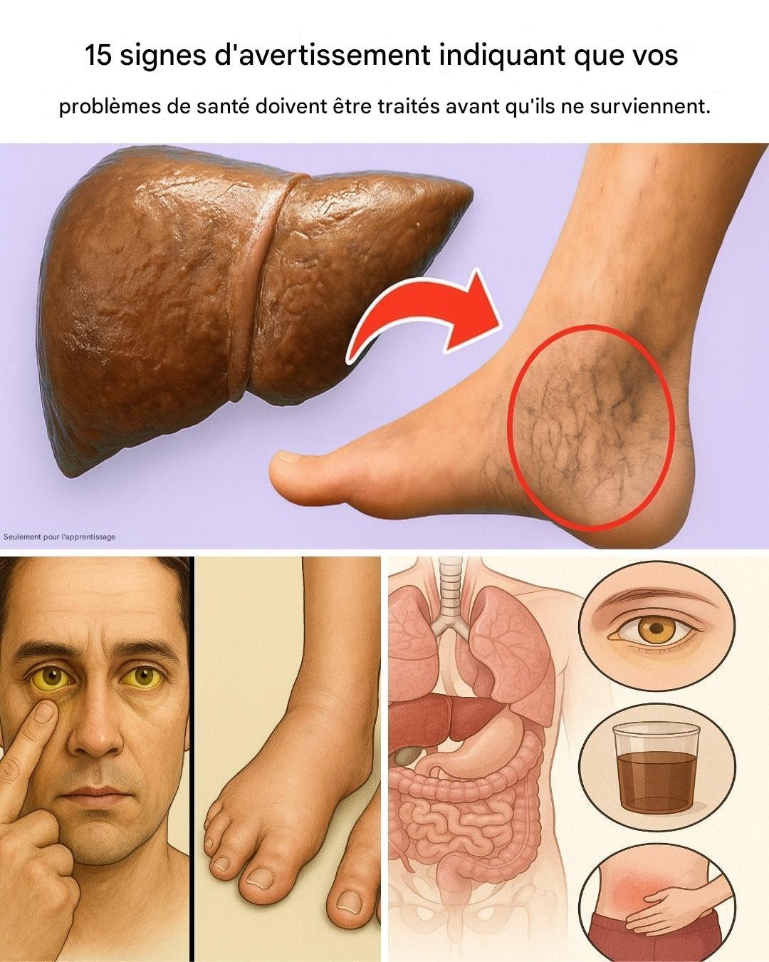 15 signes silencieux que votre foie est en difficulté – Agissez avant qu’il ne soit trop tard.??