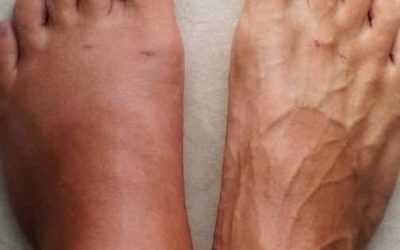 Un mois avant une crise cardiaque, votre corps propage 7 menaces dangereuses pour vous.