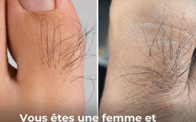 Beaucoup de femmes ignorent ce que les poils sur les orteils révèlent Voir plus