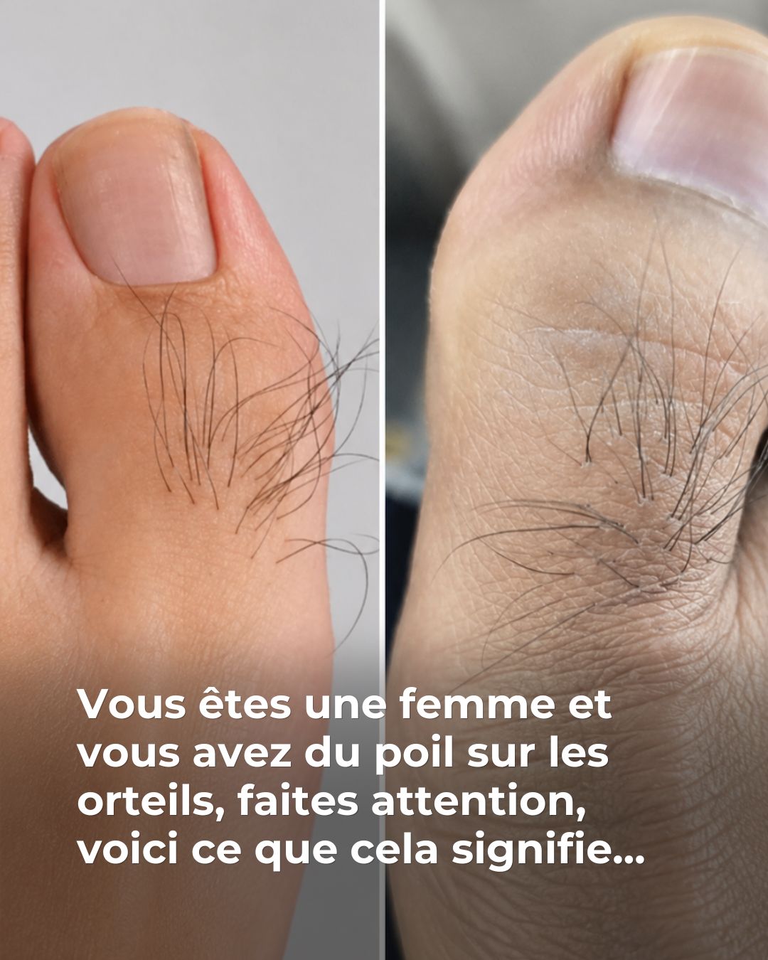 Beaucoup de femmes ignorent ce que les poils sur les orteils révèlent Voir plus