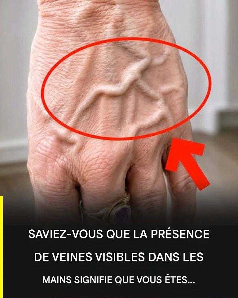 Saviez-vous que des veines apparentes signifient que vous êtes… Voir plus