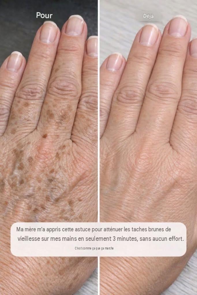 Ma mère m’a appris cette astuce pour atténuer les taches brunes sur mes mains en seulement 3 minutes et sans effort. Voici comment ça marche :