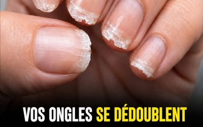 Hérôme est un vernis transparent traitant qui règle le problème en 2 applications , on peut le trouver chez Sephora. Faites l’… En voir plus