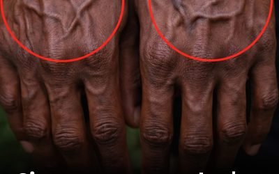 Si vos veines sont visibles, cela signifie que vous êtes… Voir plus👇