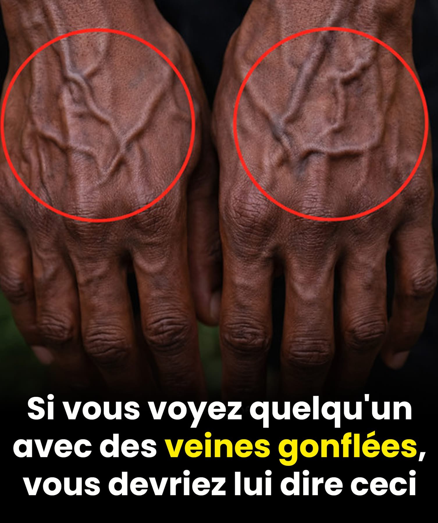 Si vos veines sont visibles, cela signifie que vous êtes… Voir plus👇