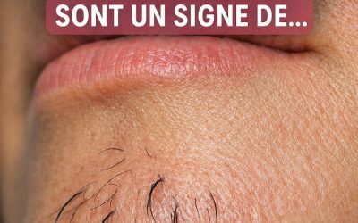 Les poils au menton d’une femme sont un signe de… Voir plus