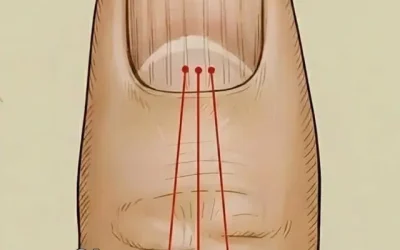 Stries sur les ongles : ce que vos mains essaient de vous dire sur votre santé