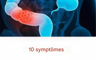 10 symptômes du cancer du côlon